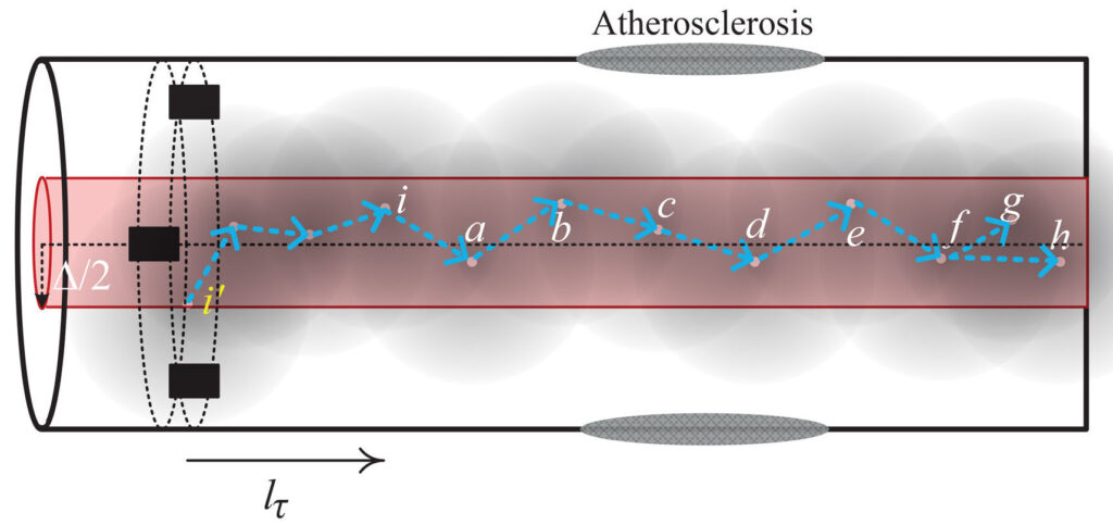 Esquema de nanosensores para estimación local de velocidad de onda de pulso